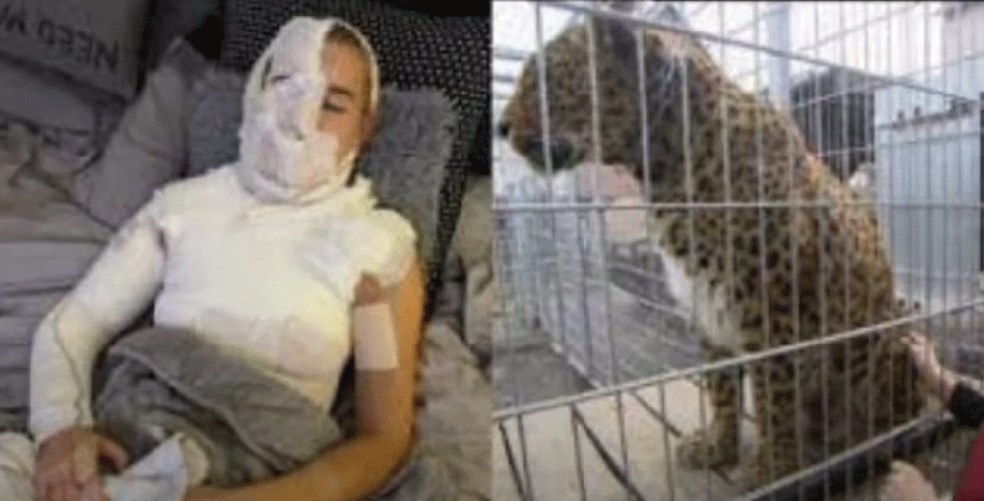 Jessica Leidolph, após o ataque de leopardo, em 2021. — Foto: Reprodução
