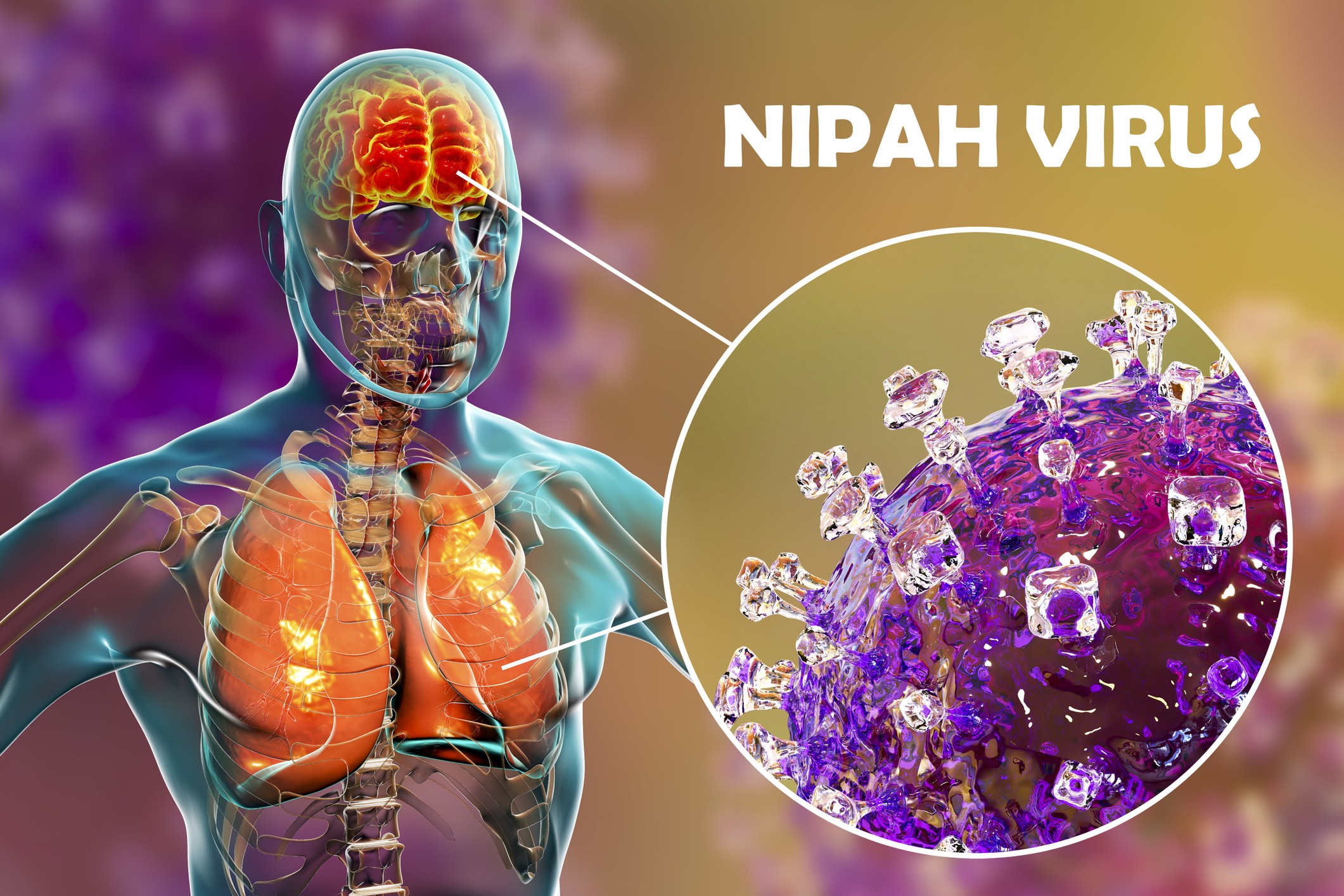 Vírus Nipah: Índia tem novo surto de doença transmitida por morcegos ...