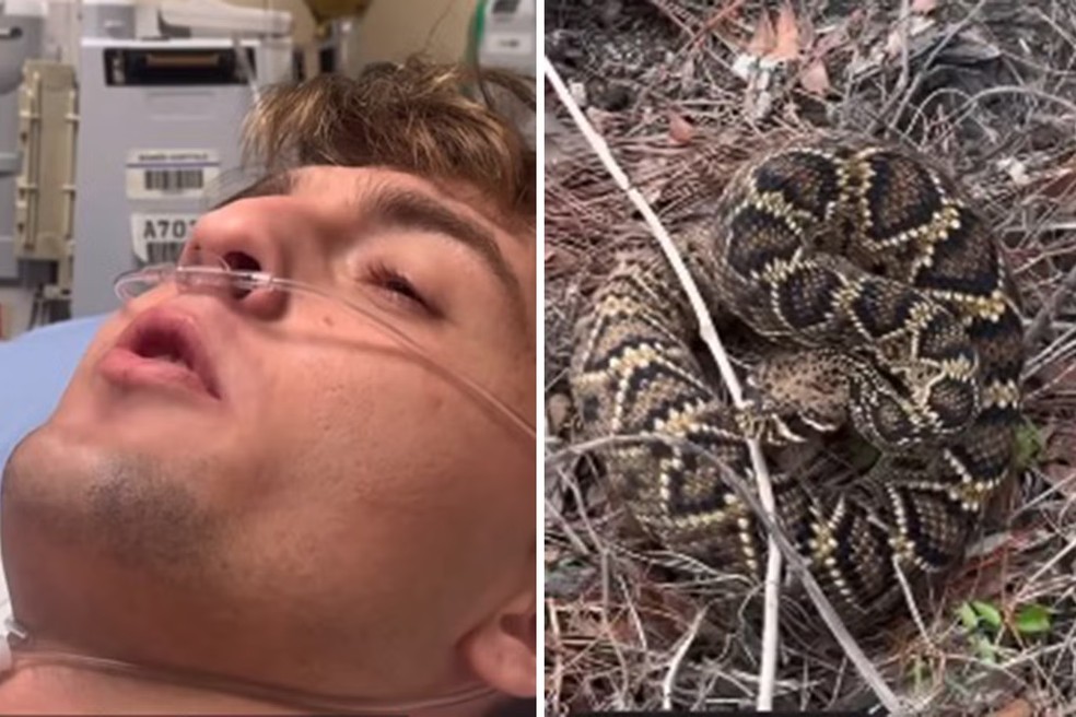 Influenciador de 'vida selvagem' é mordido por cobra cascavel na ...